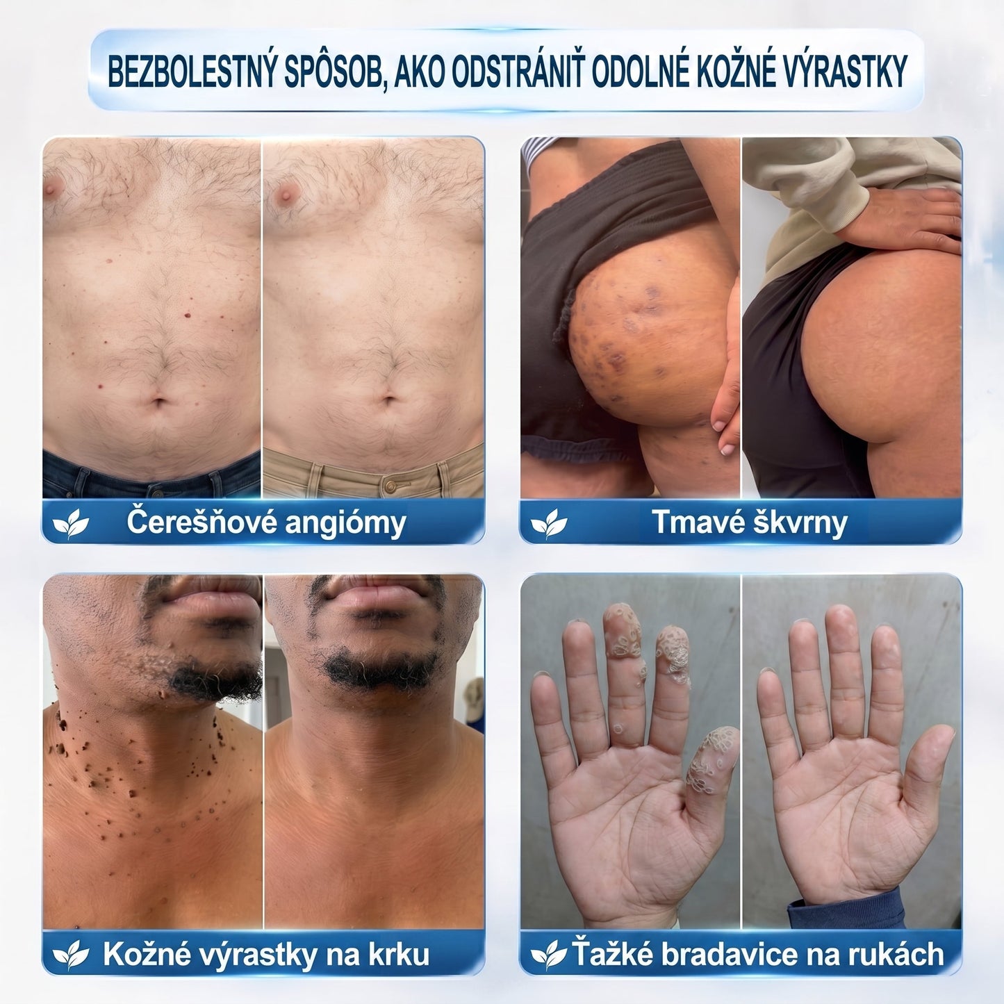 𝐏𝒊𝐜𝐝𝒐® 7-𝑫ň𝒐𝒗ý 𝑵𝒂 𝑶𝒅𝒔𝒕𝒓𝒂ň𝒐𝒗𝒂𝒏𝒊𝒆 𝑷𝒊𝒈𝒎𝒆𝒏𝒕𝒐𝒗ý𝒄𝒉 Š𝒌𝒗ŕ𝒏 𝑨 𝑱𝒂𝒛𝒊𝒆𝒗 𝑷𝒆𝒓𝒐