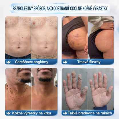 𝐏𝒊𝐜𝐝𝒐® 7-𝑫ň𝒐𝒗ý 𝑵𝒂 𝑶𝒅𝒔𝒕𝒓𝒂ň𝒐𝒗𝒂𝒏𝒊𝒆 𝑷𝒊𝒈𝒎𝒆𝒏𝒕𝒐𝒗ý𝒄𝒉 Š𝒌𝒗ŕ𝒏 𝑨 𝑱𝒂𝒛𝒊𝒆𝒗 𝑷𝒆𝒓𝒐