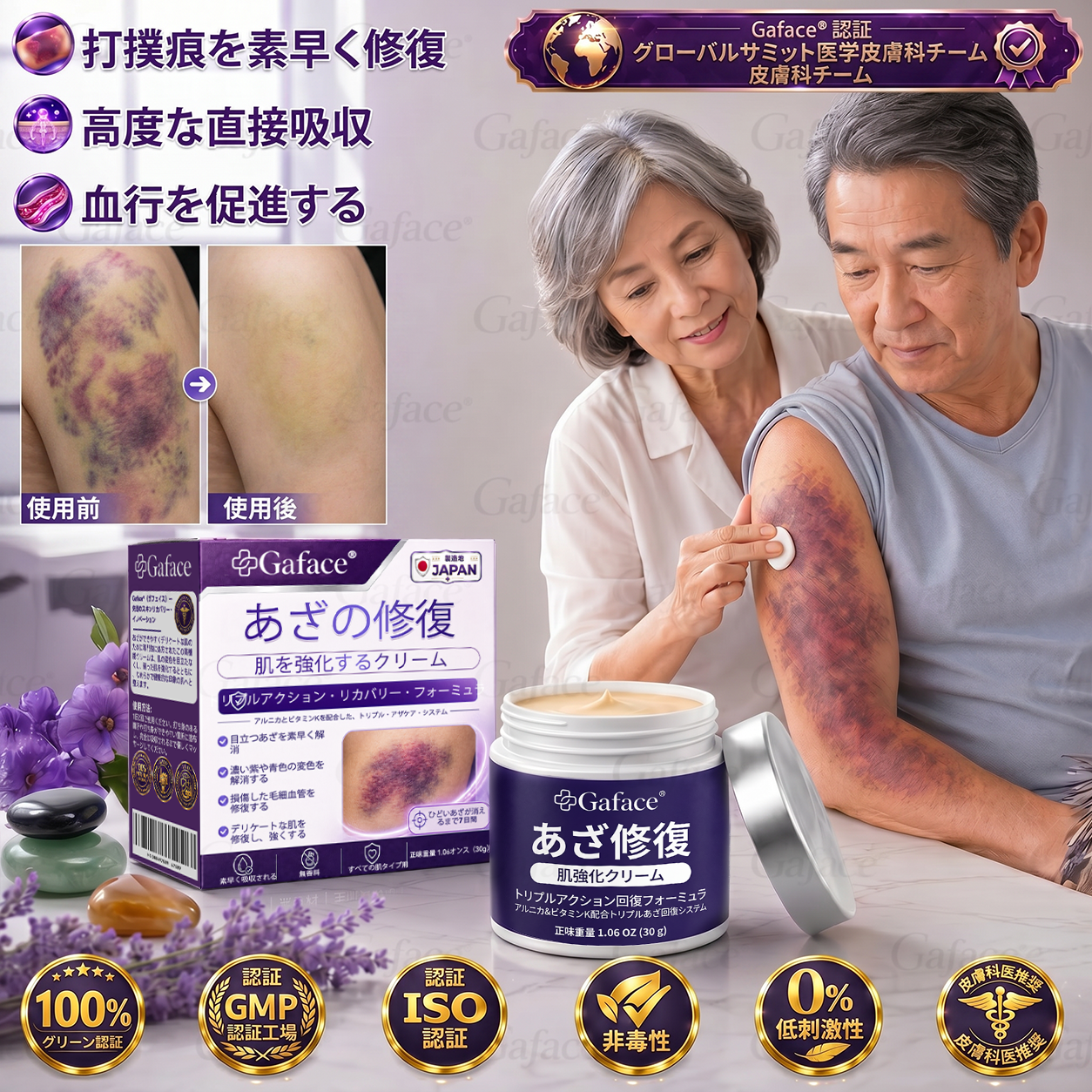 [販売数11万個突破] ✨Gaface® あざケア＆肌強化クリーム