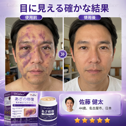 [販売数11万個突破] ✨Gaface® あざケア＆肌強化クリーム