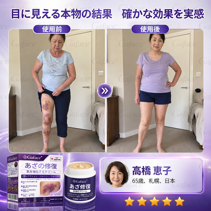 [販売数11万個突破] ✨Gaface® あざケア＆肌強化クリーム