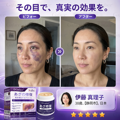 [販売数11万個突破] ✨Gaface® あざケア＆肌強化クリーム