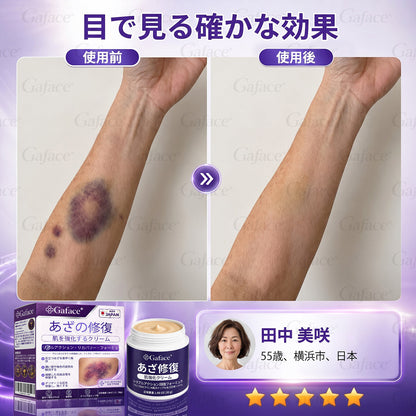 [販売数11万個突破] ✨Gaface® あざケア＆肌強化クリーム