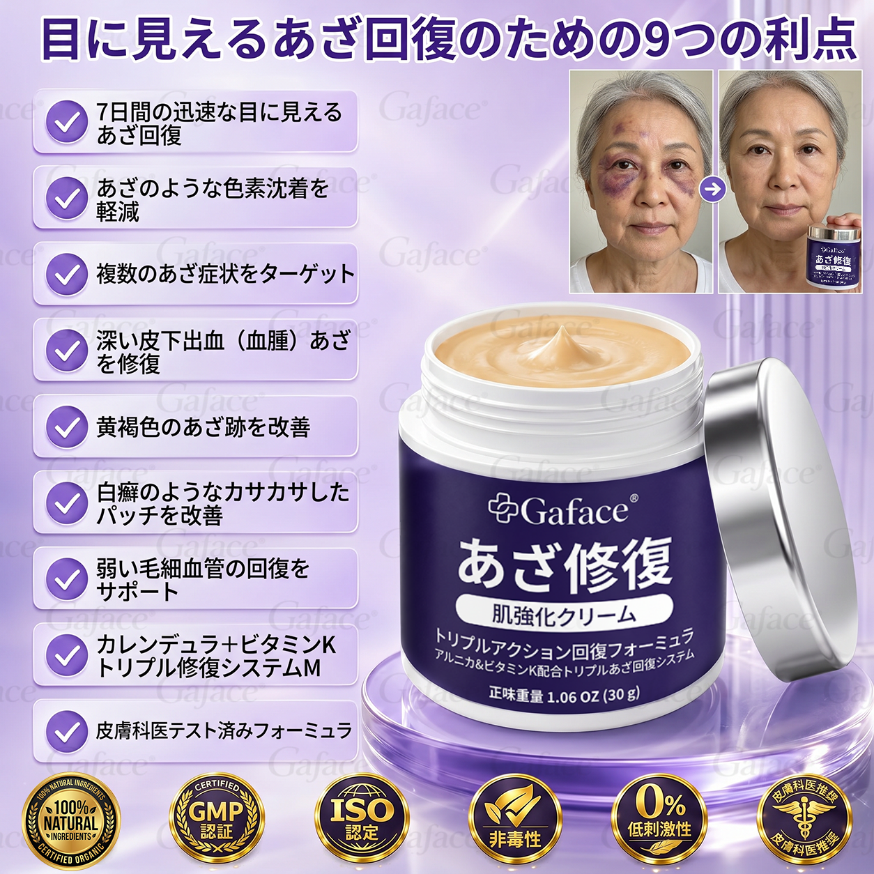 [販売数11万個突破] ✨Gaface® あざケア＆肌強化クリーム