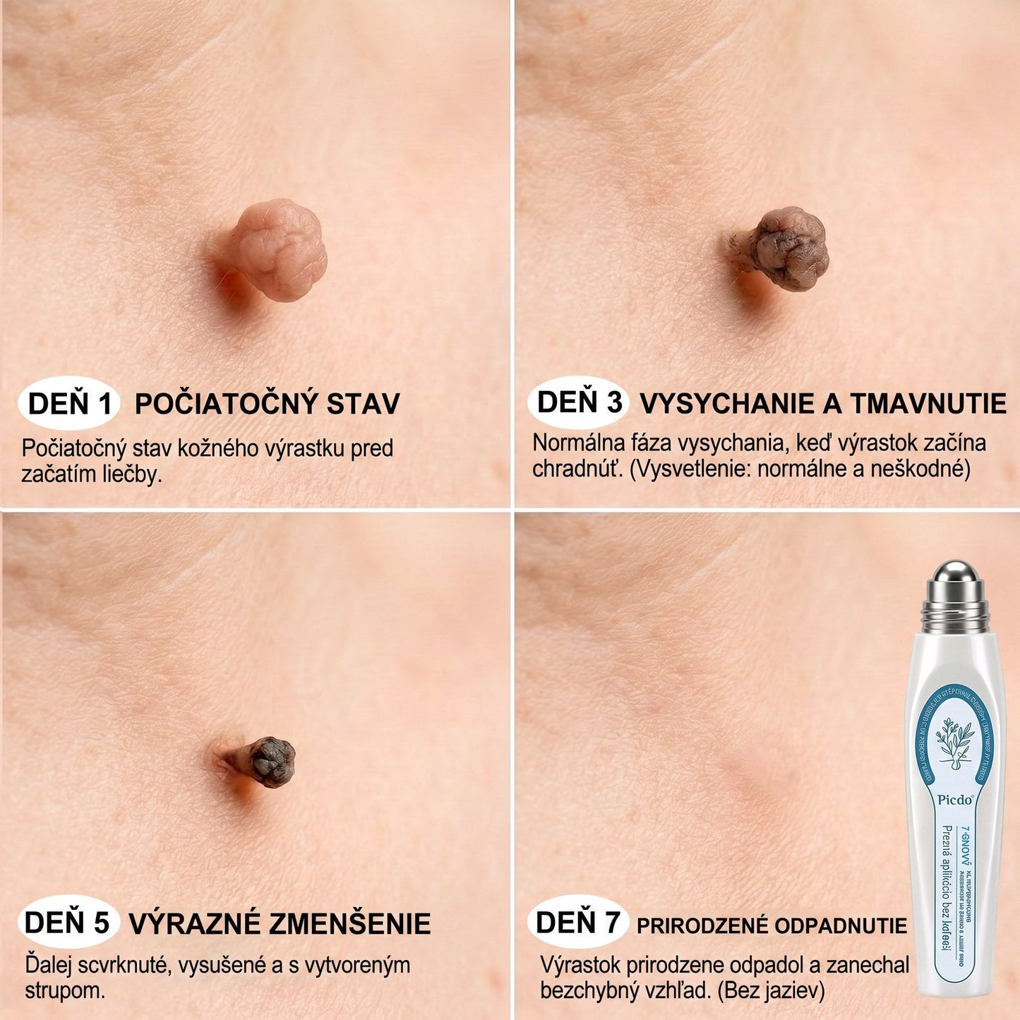 𝐏𝒊𝐜𝐝𝒐® 7-𝑫ň𝒐𝒗ý 𝑵𝒂 𝑶𝒅𝒔𝒕𝒓𝒂ň𝒐𝒗𝒂𝒏𝒊𝒆 𝑷𝒊𝒈𝒎𝒆𝒏𝒕𝒐𝒗ý𝒄𝒉 Š𝒌𝒗ŕ𝒏 𝑨 𝑱𝒂𝒛𝒊𝒆𝒗 𝑷𝒆𝒓𝒐