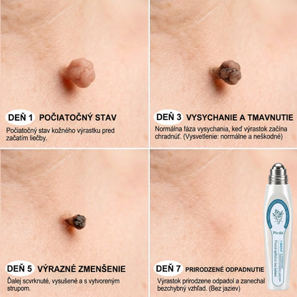𝐏𝒊𝐜𝐝𝒐® 7-𝑫ň𝒐𝒗ý 𝑵𝒂 𝑶𝒅𝒔𝒕𝒓𝒂ň𝒐𝒗𝒂𝒏𝒊𝒆 𝑷𝒊𝒈𝒎𝒆𝒏𝒕𝒐𝒗ý𝒄𝒉 Š𝒌𝒗ŕ𝒏 𝑨 𝑱𝒂𝒛𝒊𝒆𝒗 𝑷𝒆𝒓𝒐