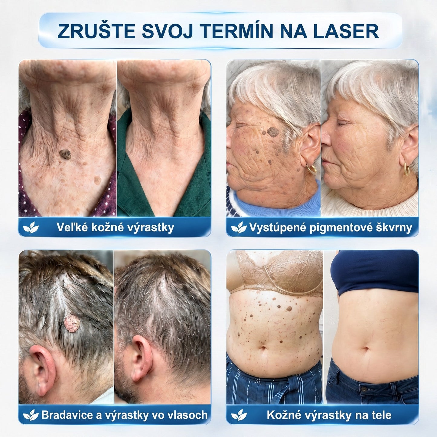 𝐏𝒊𝐜𝐝𝒐® 7-𝑫ň𝒐𝒗ý 𝑵𝒂 𝑶𝒅𝒔𝒕𝒓𝒂ň𝒐𝒗𝒂𝒏𝒊𝒆 𝑷𝒊𝒈𝒎𝒆𝒏𝒕𝒐𝒗ý𝒄𝒉 Š𝒌𝒗ŕ𝒏 𝑨 𝑱𝒂𝒛𝒊𝒆𝒗 𝑷𝒆𝒓𝒐